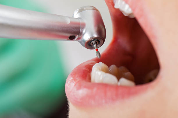Best Pediatric Emergency Dentist in Mattoon, IL